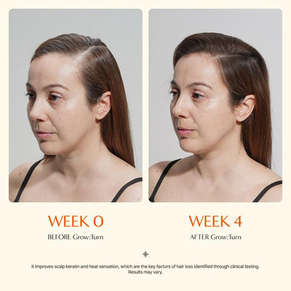 Growturn Hair Growth Serum with Built in Brush for Hair Growth & Thickening | Treatment for Thinning Hair, Hair Loss | Low Irritation, Fragrance-Free, Sulfate & Paraben-Free, 3.38 fl. oz. (Pack of 2)