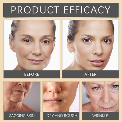 Bee Venom Moisturiser Cream Wrinkle Removal & Firming, Anti-Aging Eye&Face Bee Venom Skin Treatment Cream, Natural And Non-Irritating, Lifting & Recovery For All Skin Type (1 Pack, 20g)