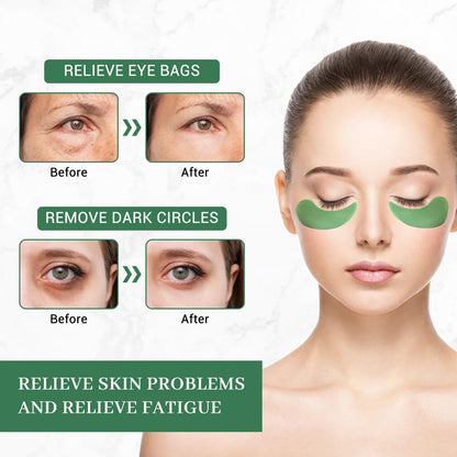 Under Eye Mask, 30 Pairs Seaweed Eye Masks for Dark Circles and Puffiness Treatment, Under Eye Patches for Puffy Eyes and Eye Bags, Gel Eye Mask Eye Pads for Face Skin Care