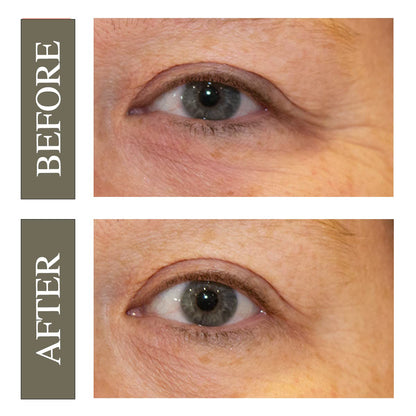 Hey Honey Open Your Eyes Lifting Eye Serum | Under Eye Cream for Dark Circles & Puffiness | Around The Eyes Hydration | Suitable For Sensitive Aging Skin | Delivers A Bright Rested look | 0.5 oz.