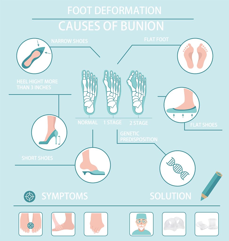 12pcs Gel Toe Spacers include sizes S M L, Toe Separators to Correct Your Toes, Toe Support Big Toe Spacers for Overlapping Toes Bunions Hammer Toe Relaxation Restore Toes to Their Original Shape