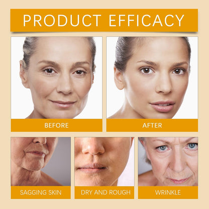 Bee Venom Moisturiser Cream Wrinkle Removal & Firming, Anti-Aging Eye & Face Bee Venom Skin Treatment Cream (3 Packs, 0.71Oz)