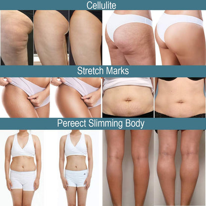 CRYOACTIVE SLIM GEL, Body Contour Gel for Firmer Skin, Anti-cellulite for Men & Women, Tightening Gel for Tummy, HIPS and Buttocks