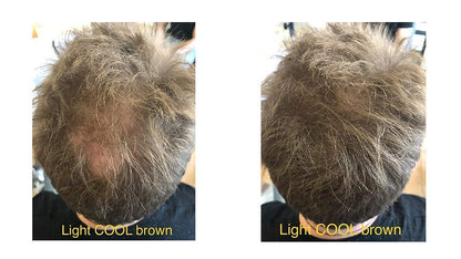 FEBRON Hair Fibers For Thinning Hair For Women & Men Hair Loss Concealer Hair Powder Volumizing Based 100% Undetectable & Natural - Bald Spots Filler (30 Gram, Light COOL Brown)