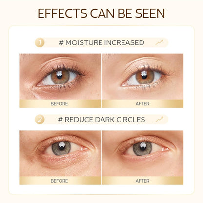 50-Pack Snail Eye Patches with Caffeine & Hyaluronic Acid - Moisturizing Golden Eye Masks for Dark Circles,Puffy Eyes, and Under-Eye Bags - Revitalize Your Skin Care Routine