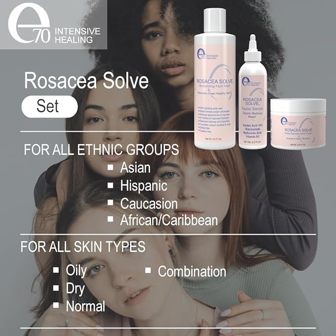 Rosacea solve set - rosacea
