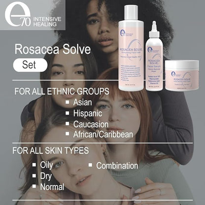 Rosacea solve set - rosacea