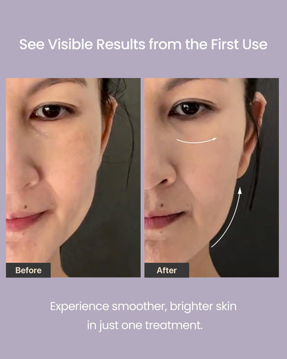 AMIRO R3 Turbo Facial Device, Precision Firming and Fine Line Smoothing Tool for Full Face, Eye Area & Jawline at-Home Therapy Purple