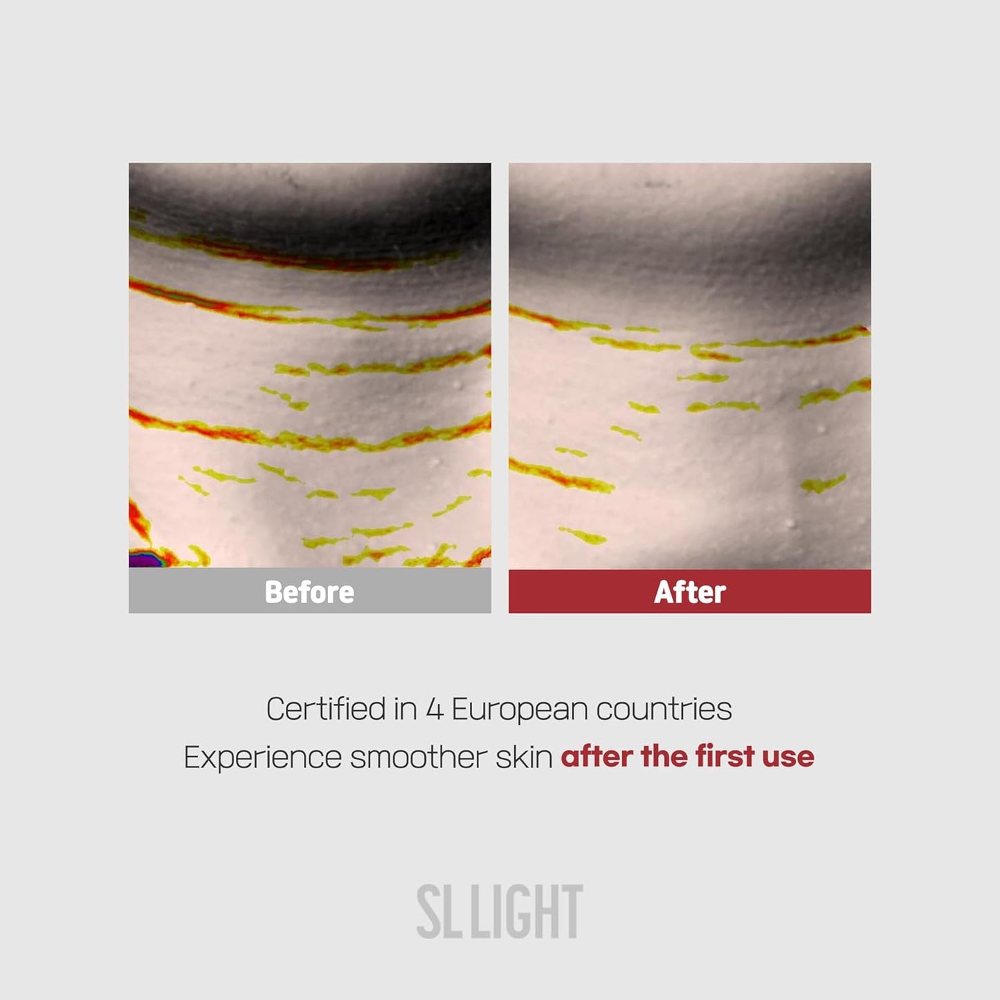 Retinal Neck Patches (1 Box, 5ea) | Neck Care Mask for Smoothing & Hydrating | With Retinal, Collagen, Elastin & Hyaluronic Acid | Korean Skincare