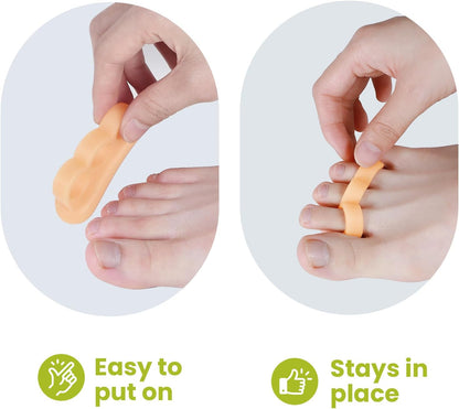 Bukihome Hammertoe Corrector Gel Toe Straighteners - 12 pcs Support Crest for Women & Men - Realign Bent, Crooked, Curled, Claw, Hammer Toes - Beige,Three Loop