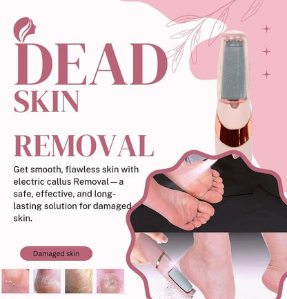 Electric Foot Callus Remover – Strongest Callus Remover for Feet, Rechargeable Pedicure Tool for Dry Heel Skin Remover, Home Spa Use - New Version (Amazon Exclusive)