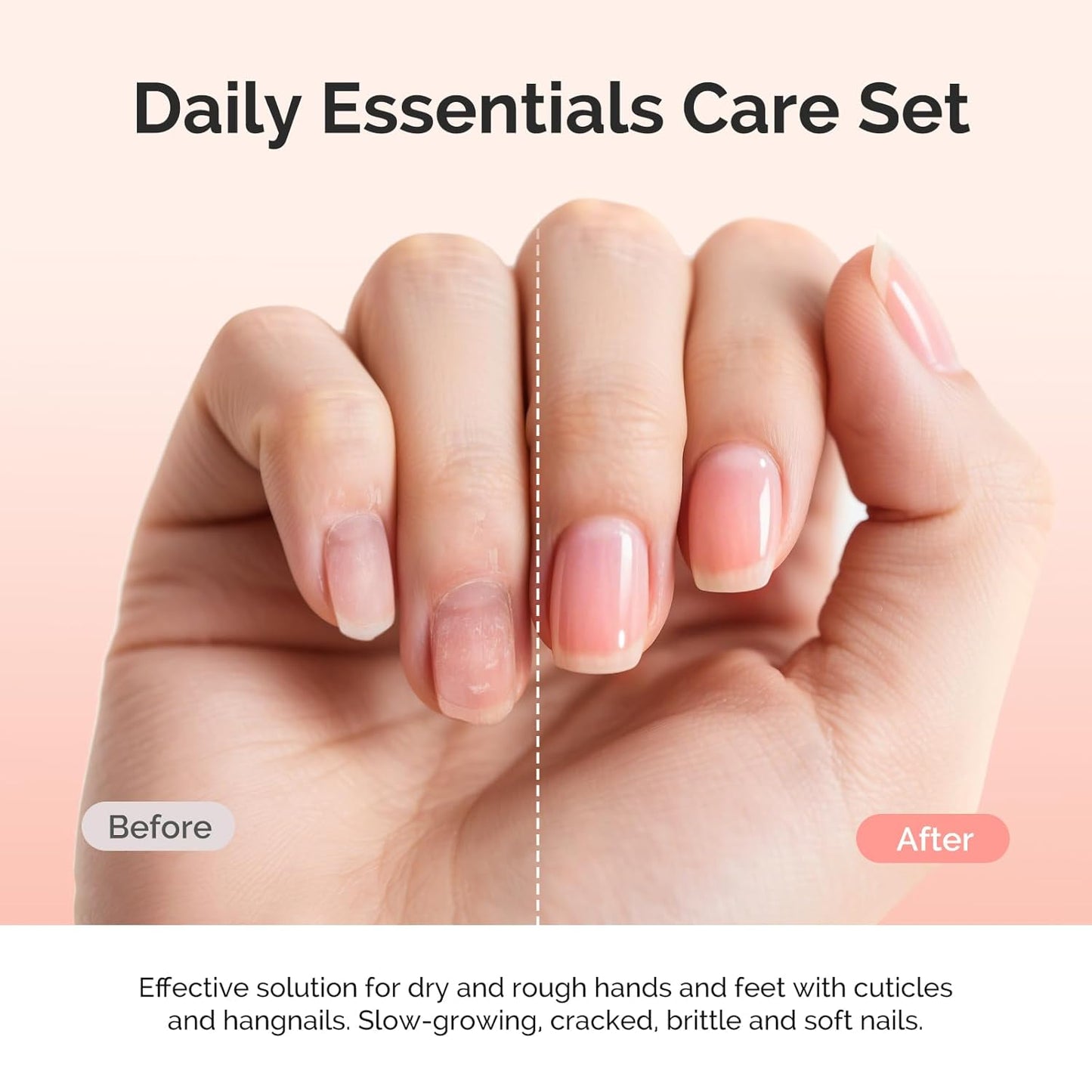 MelodySusie 25ML Cuticle Care Kit - Cuticle Oil and Cuticle Remover, Cuticle Nourishes and Softener, Promotes Nail Growth and Strength for Home and Salon Use 2PCS