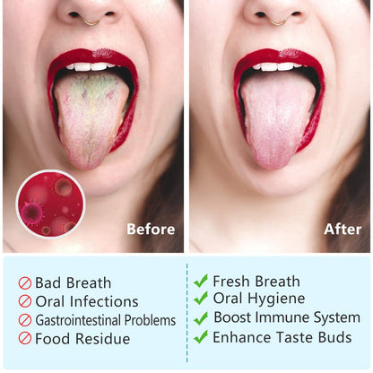 MORGLES Metal Tongue Scraper, 4 Pcs Tongue Cleaners with Case for Adults