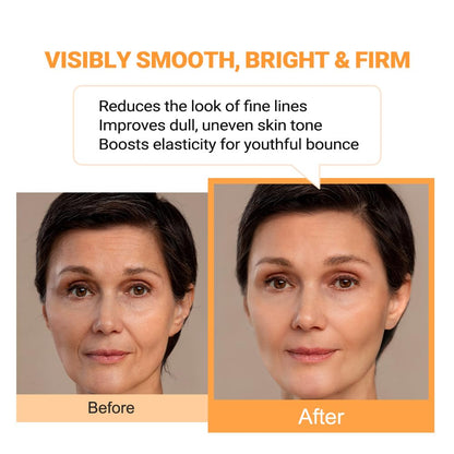 Puretiful Vitamin B12 Lotion (1 oz) | Repair & Hydrating Cream for All Ages （teen & adult)| Soothes Redness, After-Sun Skin Relief, Strengthens Barrier, Sensitive Skin Safe