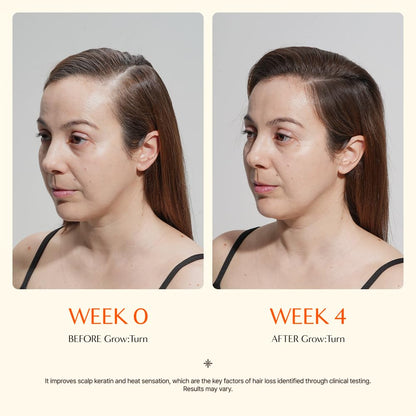 Growturn Hair Growth Serum with Built in Brush for Hair Growth & Thickening | Treatment for Thinning Hair, Hair Loss | Low Irritation, Fragrance-Free, Sulfate & Paraben-Free, 3.38 fl. oz. (Pack of 1)