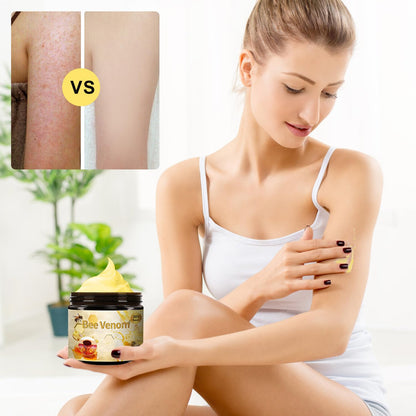 2pcs Bee Venom Treatment, New Professional Bee Venom Repair Cream, Bee Venom Cream for All Body Parts