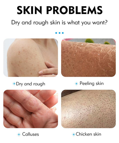 40% Urea Cream plus Salicylic Acid 2%, Anti-Cracking Nourishing and Moisturizing Hand and Foot Cream，Softens Cuticles on Rough Skin of Hands and Feet，3.05 OZ