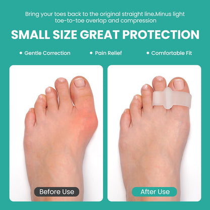 Welnove Pack of 12 Bunion Corrector, Toe Separators with 2 Loops, Big Toe Spacer Suitable for Bunion and Overlap Toe, Infused Aloe Vera Extract (Clear)