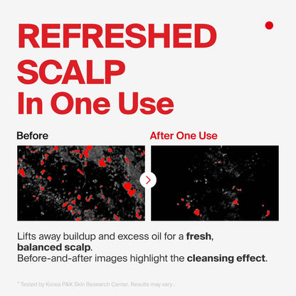 Dr.FORHAIR Folligen Shampoo | Korean Hair Care | Clarifying, Anti Dandruff, Scalp | For Hair Thickening & Fuller Looking, 16.91 fl oz