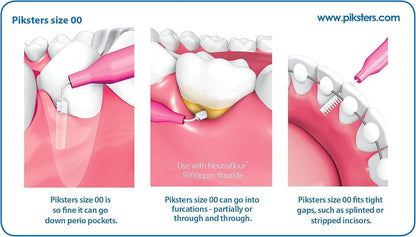 Piksters Interdental Brushes, Size 00, 100 Count (10 x 10 Packs), Interdental Tooth Brush for Extremely Tight Gaps, Gum Soft Bristles for Plaque Removal, Safe for Braces (100 pk)
