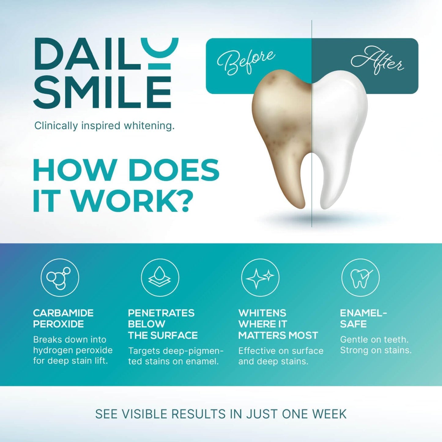 Teeth Whitening Kit with LED - Formulated for Sensitive Teeth, Hands-Free, Waterproof LED Light and 4 Gel Pens, Instant Results