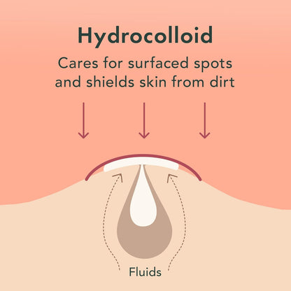 Rael Pimple Patches, Miracle Invisible Spot Cover - Hydrocolloid Acne Patch, Treatment for Breakouts, Absorbs Zits & Blemish, Korean Skin Care, 2 Sizes (24 Count)