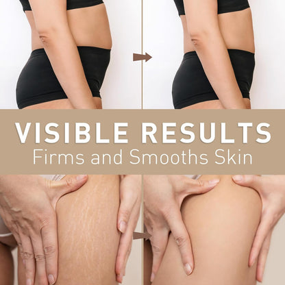 Belly Firming Cream for Tightening & Cellulite – Skin Firming Cream for Stomach, Thighs & Butt – Moisturizing & Lifting Body Lotion for Women