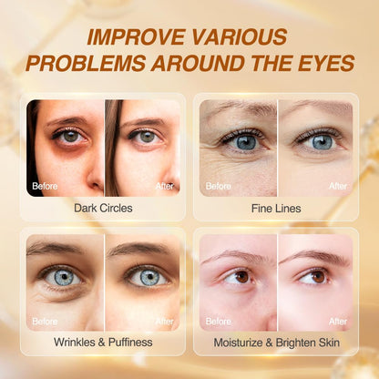 5% Caffeine Eye Serum Anti Aging, Eye Cream Reduce Dark Circles, Puffiness, Fine Lines, Wrinkles, Hyaluronic Acid Niacinamide Eye Moisturizer with 360° Massage Ball, Eye Balm for Men& Women