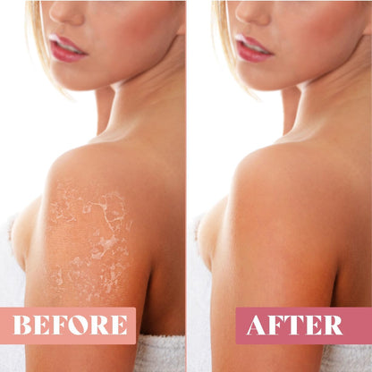 Exfoliating Glove (2 PCS) - Turkish Hammam Mitt for Bath, Exfoliating Body Scrubber Mitt, Dead & Dry Skin Remover for Body, Great for Spray Tan Removal, Smooth Skin Surface