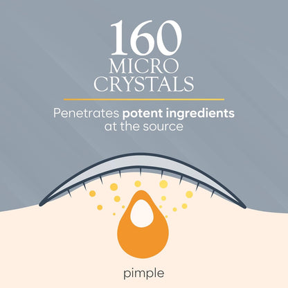 Microdart Acne Patch, Zit Patches for Cystic Acne Overnight Care, Cystic Acne Coverage, Pimple Patches Microdart Technology - Salicylic & Hyaluronic Acid (12 Count)