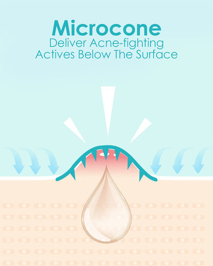 Microdart Acne Patch (18 Patches) - Hyaluronate Acid & Salicylic Acid Hydrocolloid Pimple Patch for Deep, Early and Hidden Blemishes (18 Count (Pack of 1))