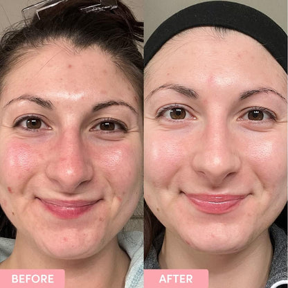 Sand & Sky Australian Essentials Brightening Toner with Niacinamide & Glycolic Acid - Marshmallow Extract Essence, Exfoliates & Strengthens Skin, 4.2 fl oz