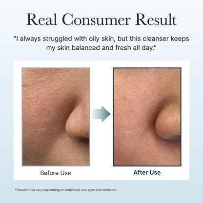 Hyssop Brightening & Deep-Cleansing Face Scrub & Exfoliator - for All Skin Types, Acne-Prone Skin & Blackheads (4.23oz)