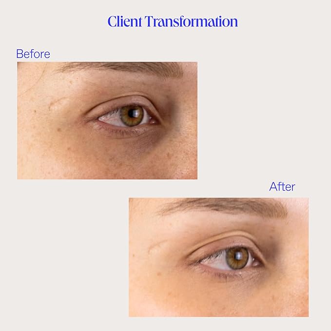 Biorepublic lost baggage under eye