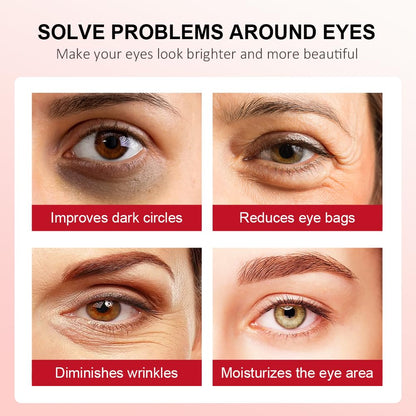 Retinol Eye Stick-Peace Out Dark Circles with this Anti-Aging Eye Cream and Brightening Balm Visible in 3-4 Weeks Reduces Fine Lines and Puffiness, Banishes Wrinkles and Dark Circles under Eye