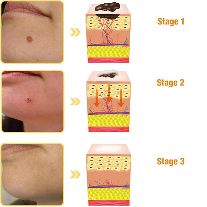 Bee Venom Cream, Professional Bee Venom Cream, Bee Venom Repair Cream for All Parts of The Body (2 Pack)