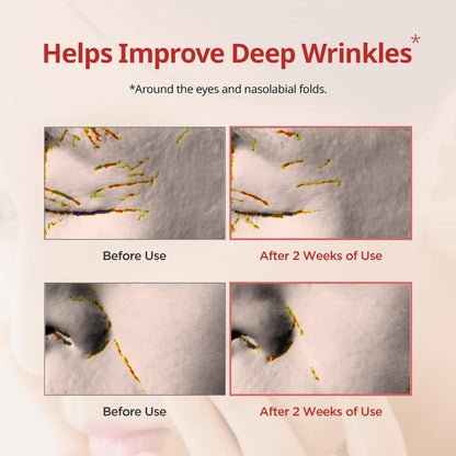 DERMATORY Pro Vita-A Retinal Under Eye Patch (60 sheets) | Reduces Dark Circles & Puffiness, Brightening, Hydrogel Ampoule, For Fine Lines & Wrinkles, With Retinal, Reallagen, Bakuchiol, Volufiline