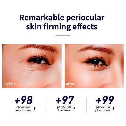 Snail Peptide Eye Serum, Under Eye Roller Cream to Reduce Dark Circles Puffiness Wrinkles Fine Lines, Niacinamide Eye Essence with 360° Massage Ball, Roll-On for Moisturizing Firming (SNAIL MUCIN)