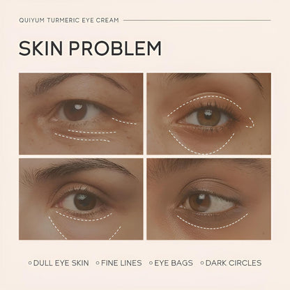 Turmeric Eye Cream, Dark Circle & Puffiness Under Eye Cream Treatment, Vitamin C & Turmeric Booster for Dull, Fine Lines, Eye Bags, Anti Aging Eye Repair Cream for Women, 0.53oz, 2 Pack