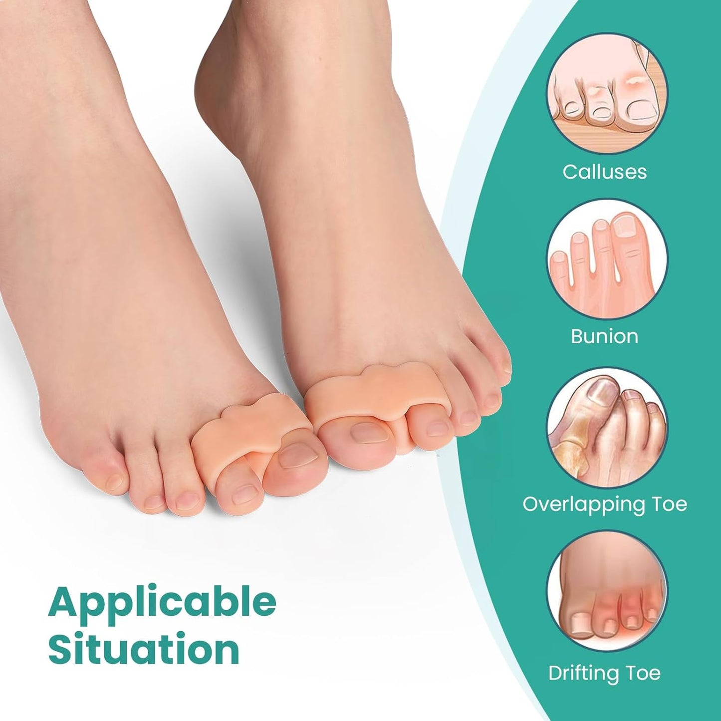 Welnove Pack of 12 Bunion Corrector, Toe Separators with 2 Loops, Big Toe Spacer Suitable for Bunion and Overlap Toe (Beige)