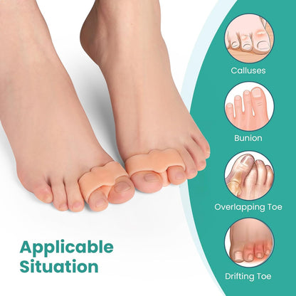 Welnove Pack of 12 Bunion Corrector, Toe Separators with 2 Loops, Big Toe Spacer Suitable for Bunion and Overlap Toe (Beige)