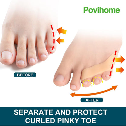 Povihome 10 Pack Pinky Toe Separator and Protectors, Triple Gel Toe Separators for Overlapping Toe, Curled Pinky Toes Separate and Protect (Beige)