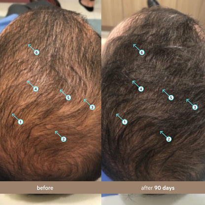 DS Labs Spectral Men’s Hair Density Serum (formerly Spectral.DNC-N), 60mL - Lightweight Leave-In for Fuller Looking, Thicker Looking Hair, Fast Absorbing, Non-Greasy, For All Hair Types