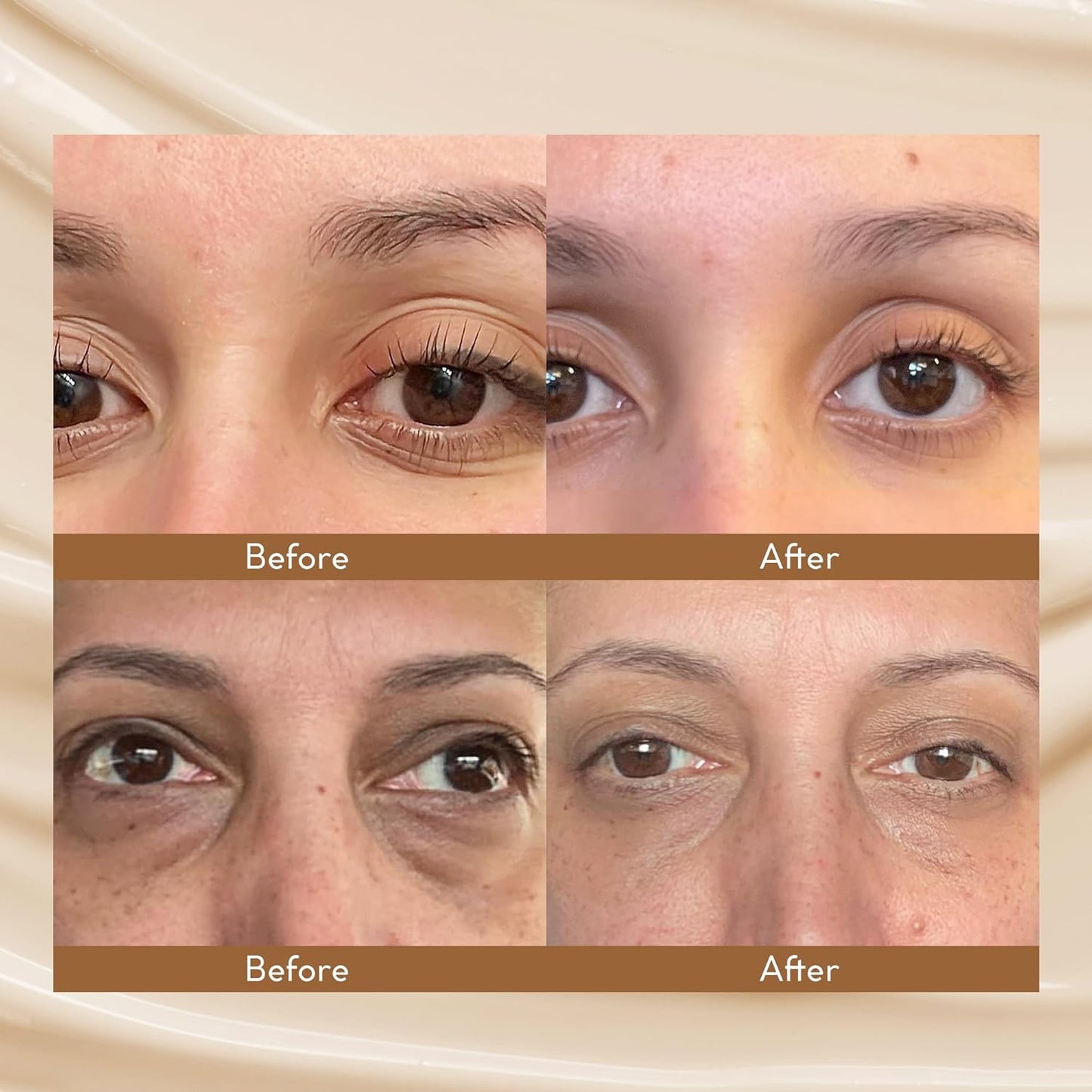 VELAMO ADVANCED Caffeine Eye Cream: for Dark Circles Puffiness Under Eye Bags Wrinkles 0.5 OZ/15g