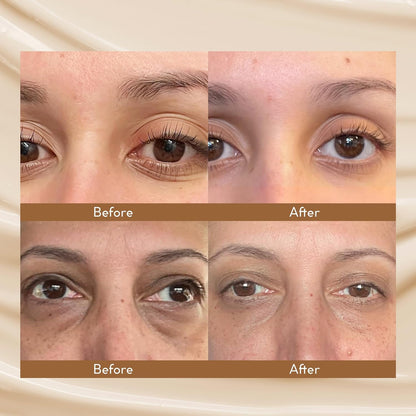 VELAMO ADVANCED Caffeine Eye Cream: for Dark Circles Puffiness Under Eye Bags Wrinkles 0.5 OZ/15g