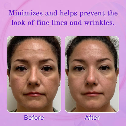 Facial Wrinkle Patches, Anti Wrinkle Patches for Forehead, Face, Frown Lines, Smile Lines, Overnight Wrinkle Pads to Reduce Fine Lines, Reusable Anti-Aging Face Patches, 160 pcs