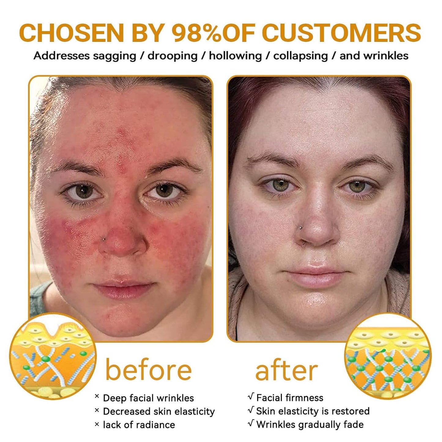 Bee Venom Skin Restoration Cream, Bee Venom Skin Treatment Cream, Repair skin and Firming, Effective In Reducing Blemishes (4)