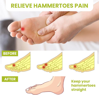 Bukihome Hammertoe Corrector Gel Toe Straighteners - 12 pcs Support Crest for Women & Men - Realign Bent, Crooked, Curled, Claw, Hammer Toes - Beige,Three Loop