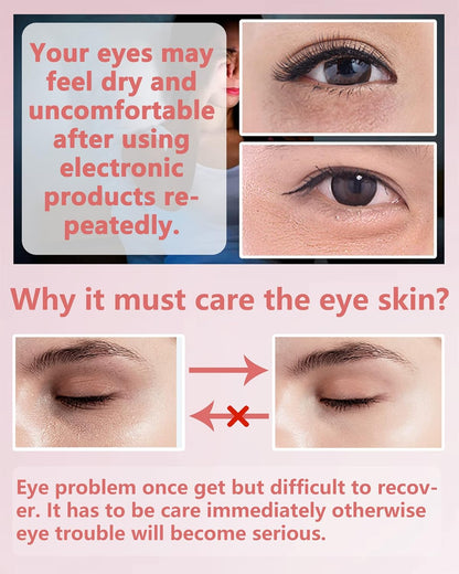 Under Eye Patches (60Pcs) - Update Eye Mask Rose Extract, Eye Treatment Mask, Under Eye Bag Treatment, Eye Mask for Puffy Eyes, Anti-Aging, Anti-Wrinkle and Fine Lines,Under eye Dark Circles for Women