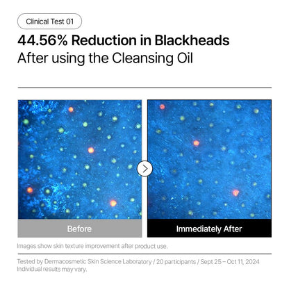 Parnell Aha Omija Ceramic Cleansing Oil 200ml / 6.76 fl.oz | blackhead melting, korean facial cleanser, korean skincare